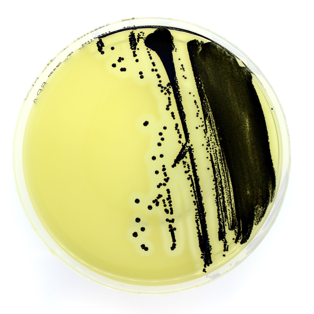 Chromatic E.coli O157