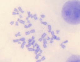 [135007134] Chromosomes humaines en sang, masc.