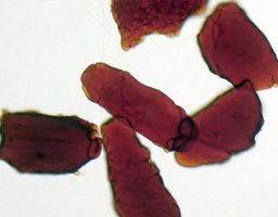 [135007260] Cellules de la pulpe de Persimmon