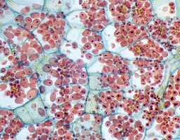 [135007266] Tubercule de Solanum tuberosum, c.