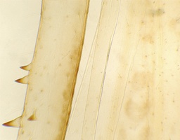 [135007311] Patte d'insect sauteur, s.e.