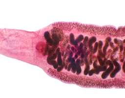 [135007316] Clonorchis sinensis, s.e.