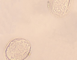 [135007331] Oeufs de Schistosoma, s.e.