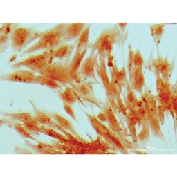 [CCK030-1KT] EZstain™ Osteocyte Staining Kit